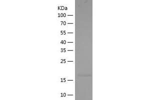 Western Blotting (WB) image for Interleukin 1 Family Member 9 (IL1F9) (AA 18-169) protein (His tag) (ABIN7123517)