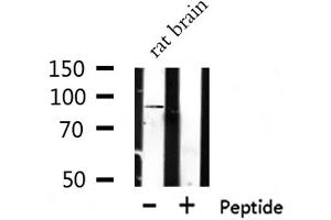 Western blot analysis of extracts of Rat brain lysate, using TLR1 antibody. (TLR1 anticorps  (Internal Region))