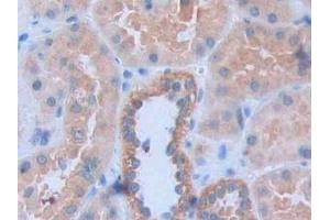 Detection of HAND1 in Human Kidney Tissue using Polyclonal Antibody to Heart And Neural Crest Derivatives Expressed Protein 1 (HAND1)