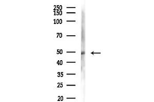 anti-Solute Carrier Family 39 (Zinc Transporter), Member 8 (SLC39A8) (Internal Region) antibody