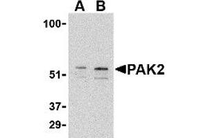 Western Blotting (WB) image for anti-P21-Activated Kinase 2 (PAK2) (C-Term) antibody (ABIN1030567) (PAK2 anticorps  (C-Term))