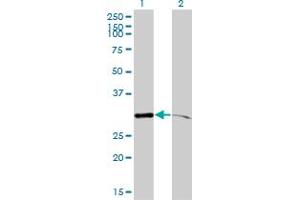 Western Blot analysis of PSMA1 expression in transfected 293T cell line by PSMA1 monoclonal antibody (M01), clone 1D9-1C7.