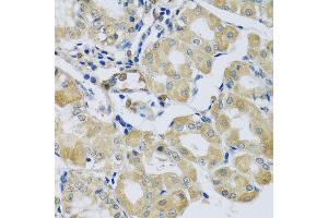 Immunohistochemistry of paraffin-embedded human stomach using SYT11 antibody at dilution of 1:100 (x40 lens). (SYT11 anticorps)