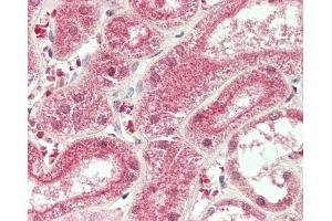 Formalin-fixed and paraffin-embedded H.