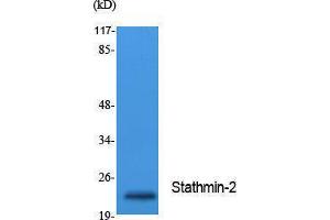 Western Blotting (WB) image for anti-Stathmin-Like 2 (STMN2) (Internal Region) antibody (ABIN3187637)