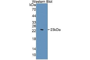 Western blot analysis of the recombinant protein. (Supervillin anticorps  (AA 1385-1525))