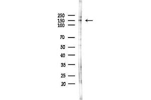 Western blot analysis of lysates from HepG2 cells(starvation,24h treatment), using PNPL Antibody at 1/1000 dilution.