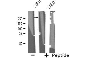 Western blot analysis of extracts from COLO cells, using MEGF8 antibody. (MEGF8 anticorps  (Internal Region))