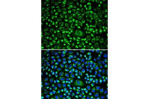 Immunofluorescence (IF) image for anti-TAP Binding Protein (Tapasin) (TAPBP) antibody (ABIN1875423) (TAPBP anticorps)