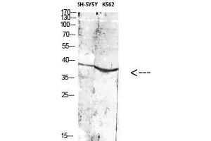 Western Blot (WB) analysis of specific cells using Antibody diluted at 1:1000.