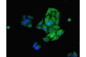 Immunofluorescent analysis of HepG2 cells using ABIN7170659 at dilution of 1:100 and Alexa Fluor 488-congugated AffiniPure Goat Anti-Rabbit IgG(H+L)