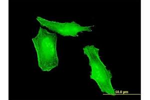 Immunofluorescence of monoclonal antibody to HRSP12 on HeLa cell. (HRSP12 anticorps  (AA 1-137))