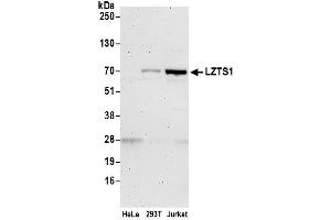 anti-Leucine Zipper, Putative Tumor Suppressor 1 (LZTS1) (AA 500-550) antibody