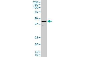 CART1 monoclonal antibody (M02), clone 2A10.