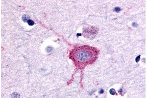Anti-GRM2 / MGLUR2 antibody  ABIN1048928 IHC staining of human brain, neurons and glia.