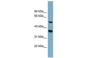 ADAMDEC1 antibody used at 1 ug/ml to detect target protein.