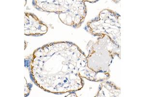 Immunohistochemistry of paraffin-embedded Human placenta using δ-Catenin/p120 Catenin antibody (ABIN7266144) at dilution of 1:500 (40x lens). (CTNND1 anticorps)