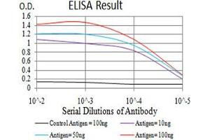 Black line: Control Antigen (100 ng);Purple line: Antigen (10ng); Blue line: Antigen (50 ng); Red line:Antigen (100 ng)