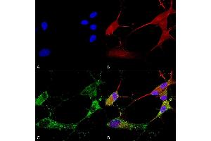 Immunocytochemistry/Immunofluorescence analysis using Mouse Anti-TARP Gamma2/4/8 (Stargazin) Monoclonal Antibody, Clone S245-36 (ABIN2483275).