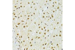 Immunohistochemistry of paraffin-embedded human liver using ADAR antibody.