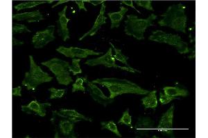 Immunofluorescence of monoclonal antibody to TIMP2 on HeLa cell. (TIMP2 anticorps  (AA 27-220))