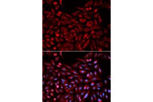 Immunofluorescence analysis of U2OS cells using NR1I3 antibody. (NR1I3 anticorps  (AA 103-352))