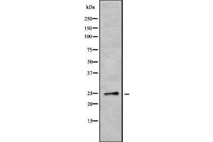 Western blot analysis of EBI3 using COLO205 whole cell lysates (EBI3 anticorps  (N-Term))