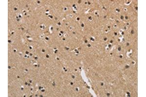 The image is immunohistochemistry of paraffin-embedded Human brain tissue using ABIN7128907(CENPN Antibody) at dilution 1/70. (CENPN anticorps)