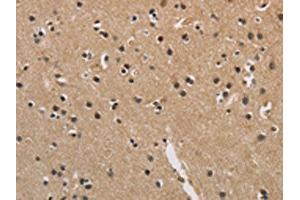 The image is immunohistochemistry of paraffin-embedded Human brain tissue using ABIN7128907(CENPN Antibody) at dilution 1/70.