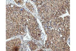 IHC analysis of SDE2 using anti-SDE2 antibody (ABIN7599603). (C1orf55 anticorps  (AA 10-447))