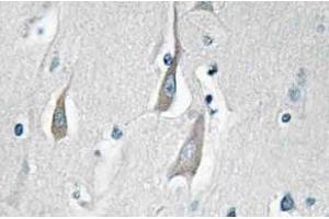 Immunohistochemistry (IHC) analyzes of p-CaMKIIalpha/delta antibody in paraffin-embedded human brain tissue. (CAMK2A anticorps  (pThr286))