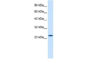 WB Suggested Anti-ZNF22 Antibody Titration:  1. (Zinc Finger Protein 22 anticorps  (C-Term))