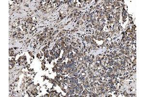 IHC analysis of Astrin/Deepest/SPAG5 using anti-Astrin/Deepest/SPAG5 antibody (ABIN7602399).