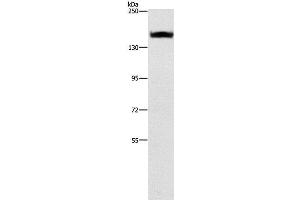Western Blot analysis of A431 cell using ITGA2 Polyclonal Antibody at dilution of 1:300 (ITGA2 anticorps)