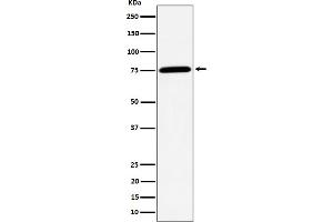 Western blot analysis of PPM1G expression in Jurkat cell lysate.