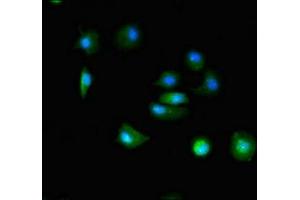 TTC19 anticorps  (AA 108-380)