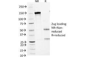 SDS-PAGE Analysis Purified CD1a Mouse Monoclonal Antibody (66IIC7). (CD1a anticorps)