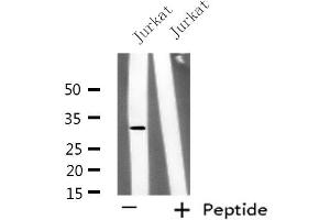 Western blot analysis of extracts from Jurkat cells, using KCNK6 antibody. (KCNK6 anticorps  (C-Term))