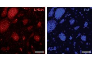LIN28A antibody (pAb) tested by Immunocytochemistry Mouse embryonic stem cells (mESCs) grown on mouse embryonic fibroblast feeder cells (MEFs) were fixed with 4 % paraformaldehyde for 10 minutes at room temperature. (LIN28A anticorps  (C-Term))