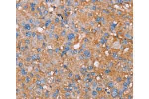 Immunohistochemistry (IHC) image for anti-P Antigen Family, Member 5 (Prostate Associated) (PAGE5) antibody (ABIN2430601) (PAGE5 anticorps)