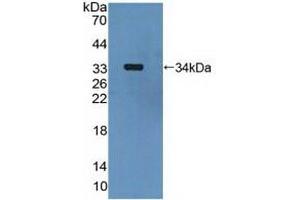Western blot analysis of recombinant Human MAP2K6. (MAP2K6 anticorps  (AA 46-306))