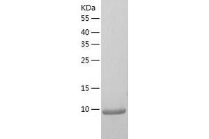 Western Blotting (WB) image for Chemokine (C-C Motif) Ligand 3 (CCL3) (AA 23-92) (Active) protein (His tag) (ABIN7122298)