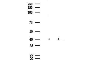 anti-Interleukin 2 Receptor, gamma (IL2RG) (N-Term) antibody