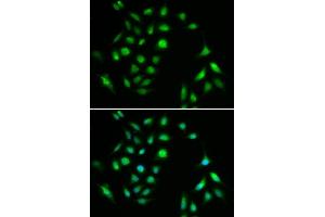 Immunofluorescence analysis of A549 cell using CHUK antibody. (IKK alpha anticorps  (C-Term))