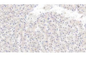 Detection of b2M in Human Liver Tissue using Monoclonal Antibody to Beta-2-Microglobulin (b2M)