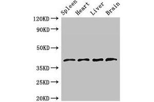 Western Blot Positive WB detected in: Rat spleen tissue, Mouse heart tissue, Mouse liver tissue, Mouse brain tissue All lanes: LEFTY1 antibody at 2. (LEFTY1 anticorps  (AA 223-260))