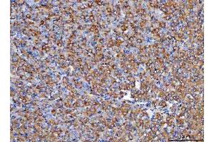 IHC analysis of RBP1 using anti-RBP1 antibody (ABIN7599586). (RBP1 anticorps  (AA 10-135))