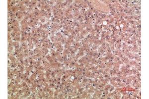 Immunohistochemical analysis of paraffin-embedded human-liver, antibody was diluted at 1:200