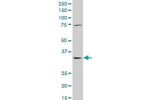 QPRT polyclonal antibody (A01), Lot # 060803QCS1 Western Blot analysis of QPRT expression in K-562 .