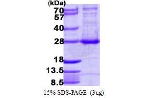 SDS-PAGE (SDS) image for ADP-Ribosylation Factor-Like 4A (ARL4A) (AA 1-200) protein (His tag) (ABIN7529175)